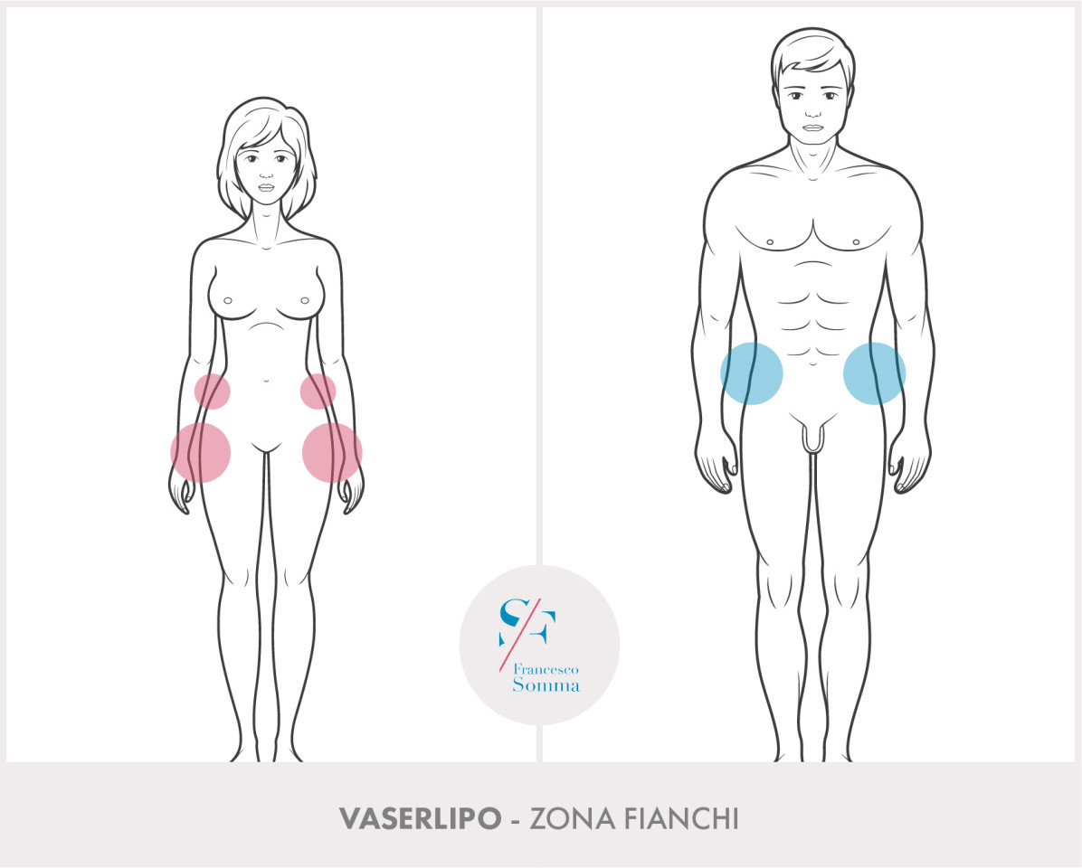 Dott. Francesco Somma - Chirurgia estetica