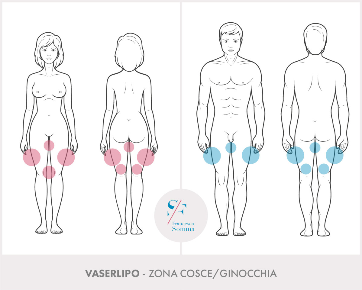 Dott. Francesco Somma - Chirurgia estetica
