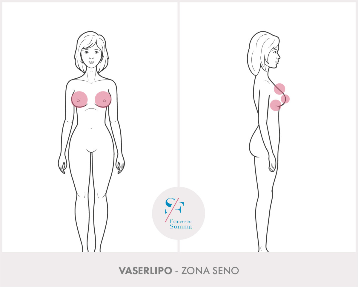 Dott. Francesco Somma - Chirurgia estetica