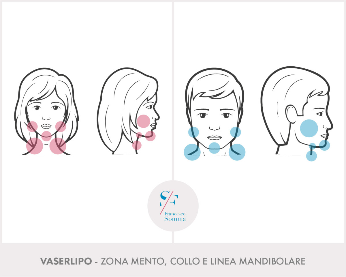 Dott. Francesco Somma - Chirurgia estetica
