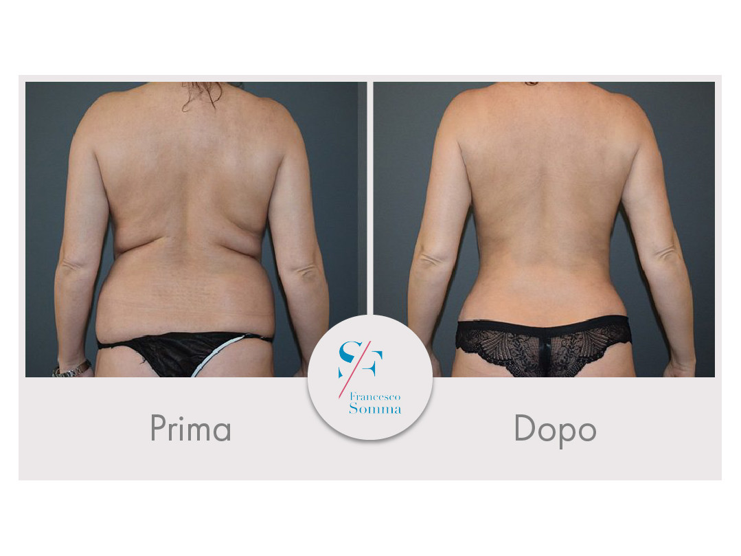 Dott. Francesco Somma - Chirurgia estetica