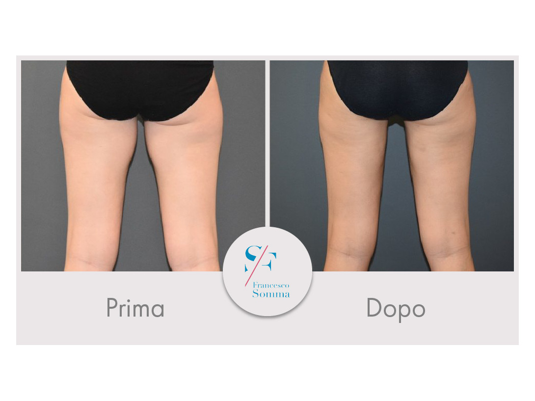 Dott. Francesco Somma - Chirurgia estetica