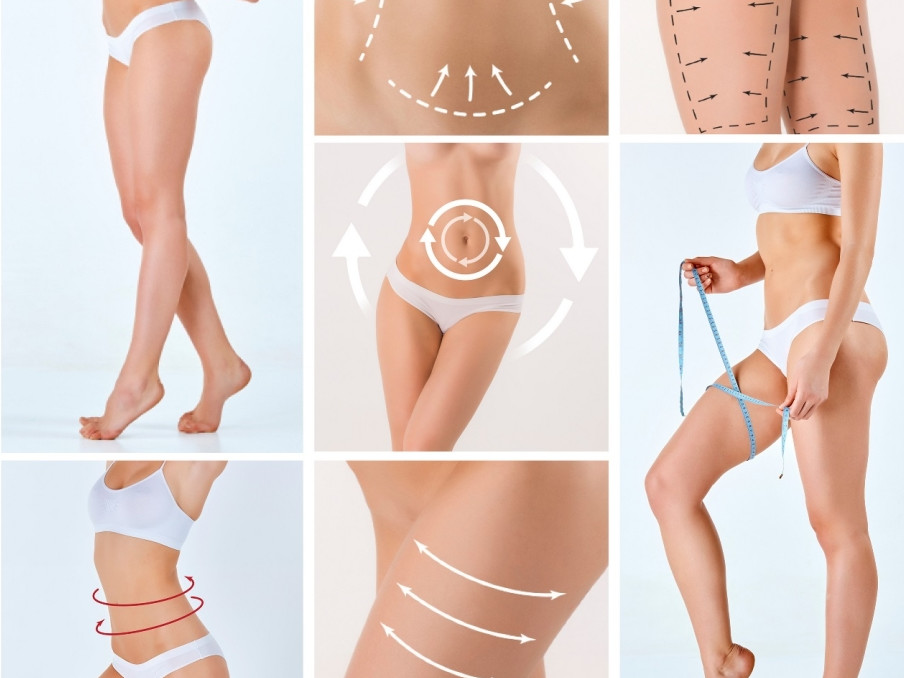Differences between classic liposuction and Vaser lipo - Dr Somma