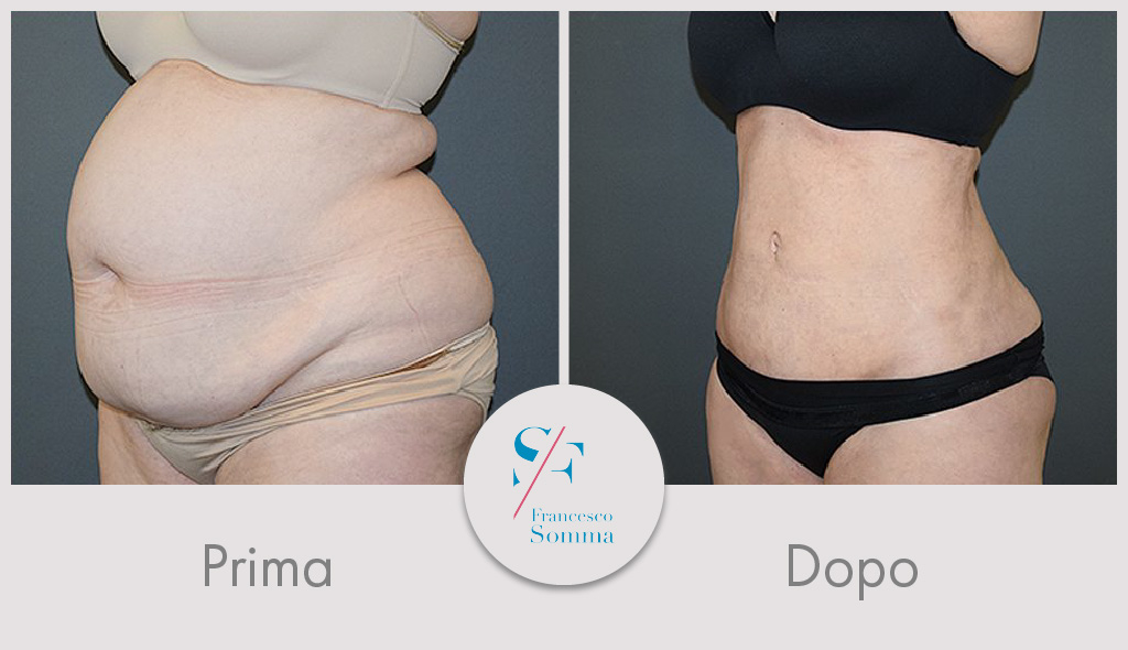 Dott. Francesco Somma - Chirurgia estetica